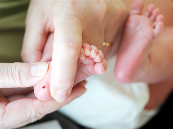 Как и зачем делают анализ из пятки у новорожденного: процесс пяточного тестирования на возможные патологии
