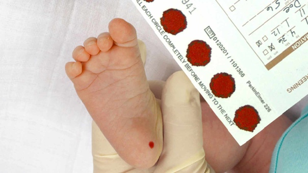 Для чего берут анализ крови из пятки новорожденного thumbnail