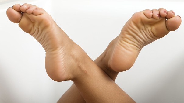 Как вылечить больные пятки ног thumbnail